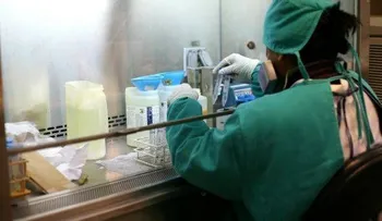 Argentinos crean prueba para detectar tuberculosis