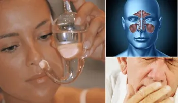 5 Tratamientos para la sinusitis 