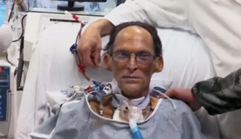 Dos médicos cambian medicina para siempre logrando que un hombre viva sin corazón
