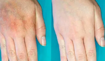 Esta crema hace temblar industria de los cosméticos, elimina las manchas como por magia