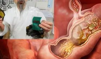 Médico japonés pública cómo eliminar la bacteria Helicobacter del organismo