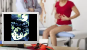  5 causas afectan flora intestinal 