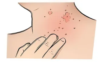 ¿Cómo saber si deberías dejar de comer gluten?