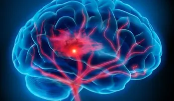 Crean un dispositivo que reduce secuelas en pacientes de parálisis cerebral