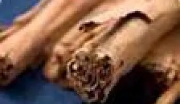 Aceite esencial de canela para piojos, sarnas, verrugas, reumatismo, estrés y otros casos