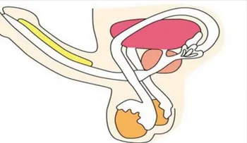 Este remedio que acaba con tu problema de erección para siempre 