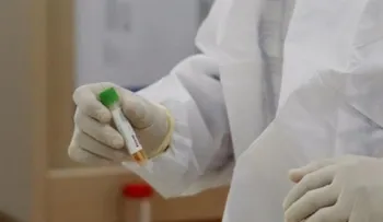 Científicos identifican cepa del virus más contagiosa, pero otros discrepan