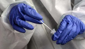 Más de medio millón de casos confirmados de Covid-19 en el mundo en un día