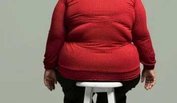La genética es el factor más importante en la obesidad