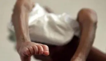 Perra daba de mamar a un niño desnutrido de dos años