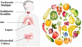 6 deficiencias de nutrientes relacionadas con enfermedades autoinmunes
