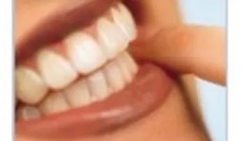 Desarrollan biomateriales dentales con nanopartículas 