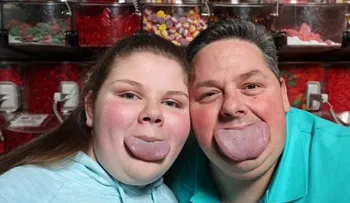 Con la lengua más ancha del mundo