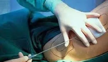 Someten doctora acusada de mala práctica