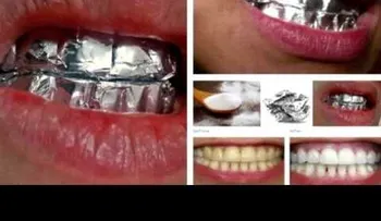 Blanquea tus dientes usando papel aluminio en 20 minutos