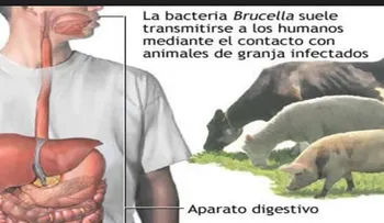 La brucelosis: Enfermedad bacteriana que se transmite al ser humano por animales 