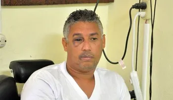Recuperación de Danny Polanco es un proceso lento