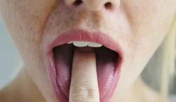 5 mitos comunes sobre la bulimia