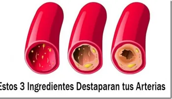 Limpia tus Arterias Coronarias con estos 3 ingredientes mágicos...