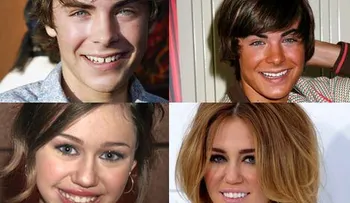 La claves para tener una sonrisa envidiable después de los 30 