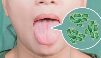 Las diferentes causas por la que nos duele la lengua. Entérate