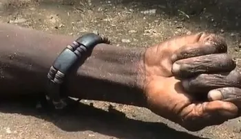 ¡Impactante!: enfermo con ébola "revive" (Video)