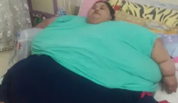 Muere la mujer más obesa del mundo por complicaciones de salud