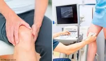 La tendinitis. Causas, síntomas y prevención