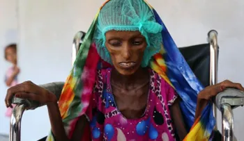 20 millones de personas podrían morir de hambre en los próximos meses, dice la FAO