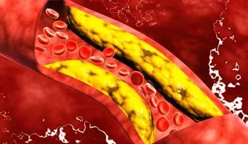 Destapa tus arterias y regula tu presión baja con solo 4 cucharadas de esta bebida. Es imperdible
