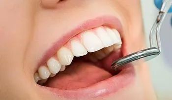 ¿Quistes bucales? Conoce esta patología silente y muy común 