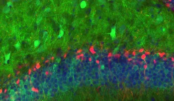 Revolucionario estudio logró observar por primera vez el nacimiento de nuevas neuronas