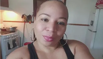 Dominicana Emy Duvergé, residente en NJ muere después de siete cirugías estéticas en RD
