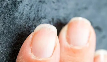 ¿Sufres de uñas débiles? 5 remedios naturales para combatirlas