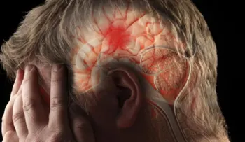 Sociedad Dominicana de Neurología urge ampliar respuesta estatal ante accidentes cerebrovasculares