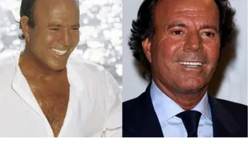Algunos personajes famosos con pelo implantado y otros que usan peluca