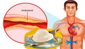 Conoce la mejor medicina para el colesterol y la presión arterial alta