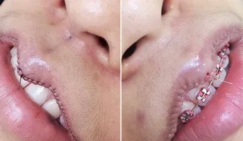 Una FUERTE tendencia de belleza que genera revuelo. ¿Usted harías esto? 