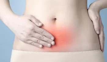  Endometriosis es una enfermedad que puede causar infertilidad en las mujeres 