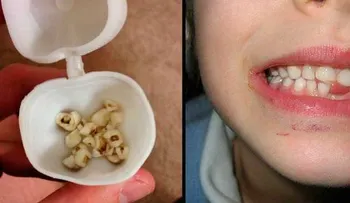 ¡No botes los dientes de leche de tus hijos! Esos pequeños recuerdos son una mina de oro para tu saludâ?¦