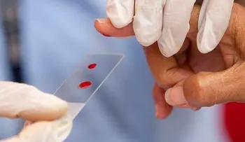 La hemofilia, el miedo a vivir siempre con el peligro de las hemorragias