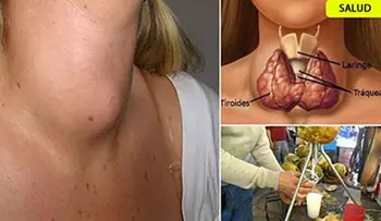 Los médicos escoden el secreto: así se cura las tiroide con tan solo este remedio