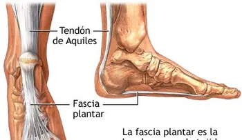 Si siente un dolor intenso en los pies puede ser la ruptura del tendón de Aquiles