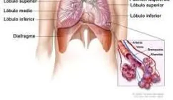 Efectivos remedios para la bronquitis, la tos, el asma y las enfermedades pulmonares