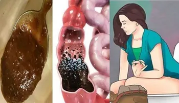 Una sola cucharada y saldrá corriendo al baño para eliminar todos los desechos del intestino.