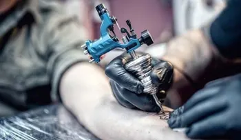 ¿Se puede eliminar un tatuaje?