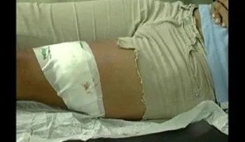 Hieren en el rostro a una estudiante para robarle celular
