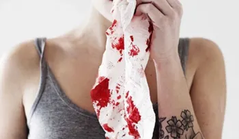 Hemofilia, la condición es altamente discapacitante