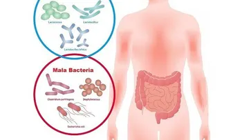 Probióticos para el estrés, la depresión y la ansiedad