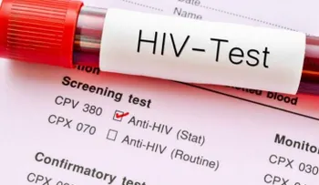 Prueban en humanos un nuevo tipo de vacuna contra el sida